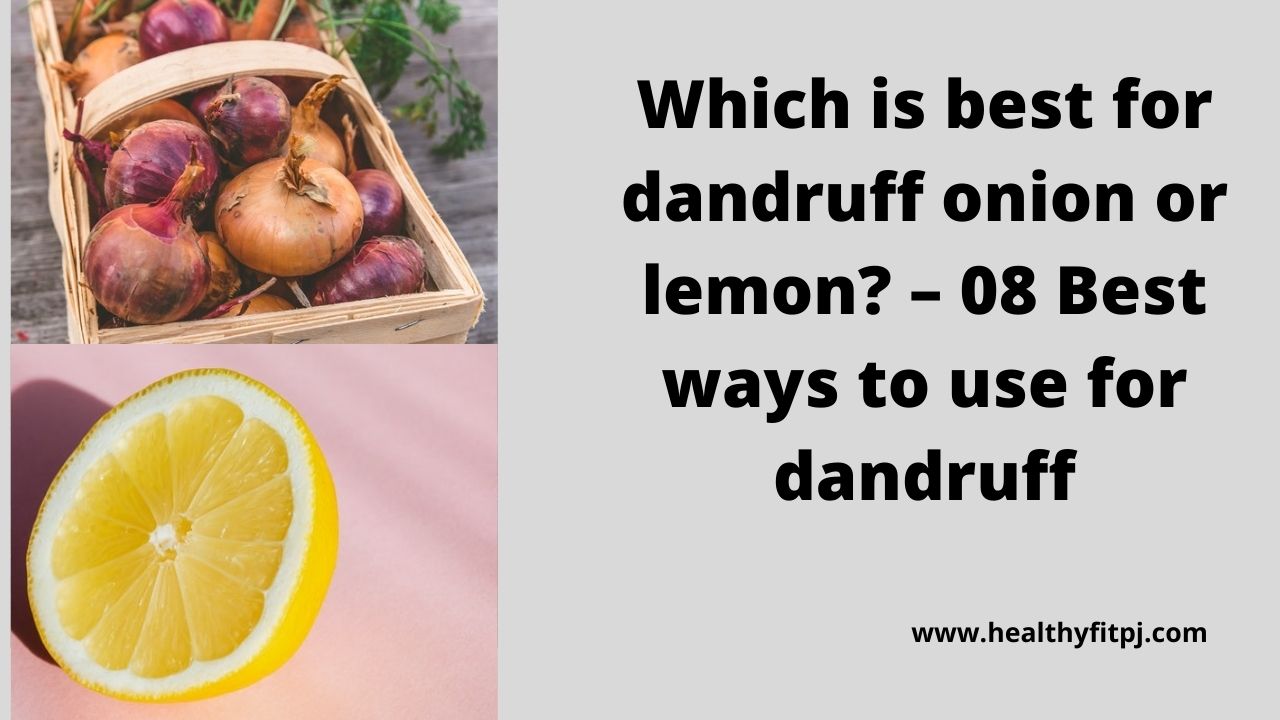 Which is best for dandruff onion or lemon
