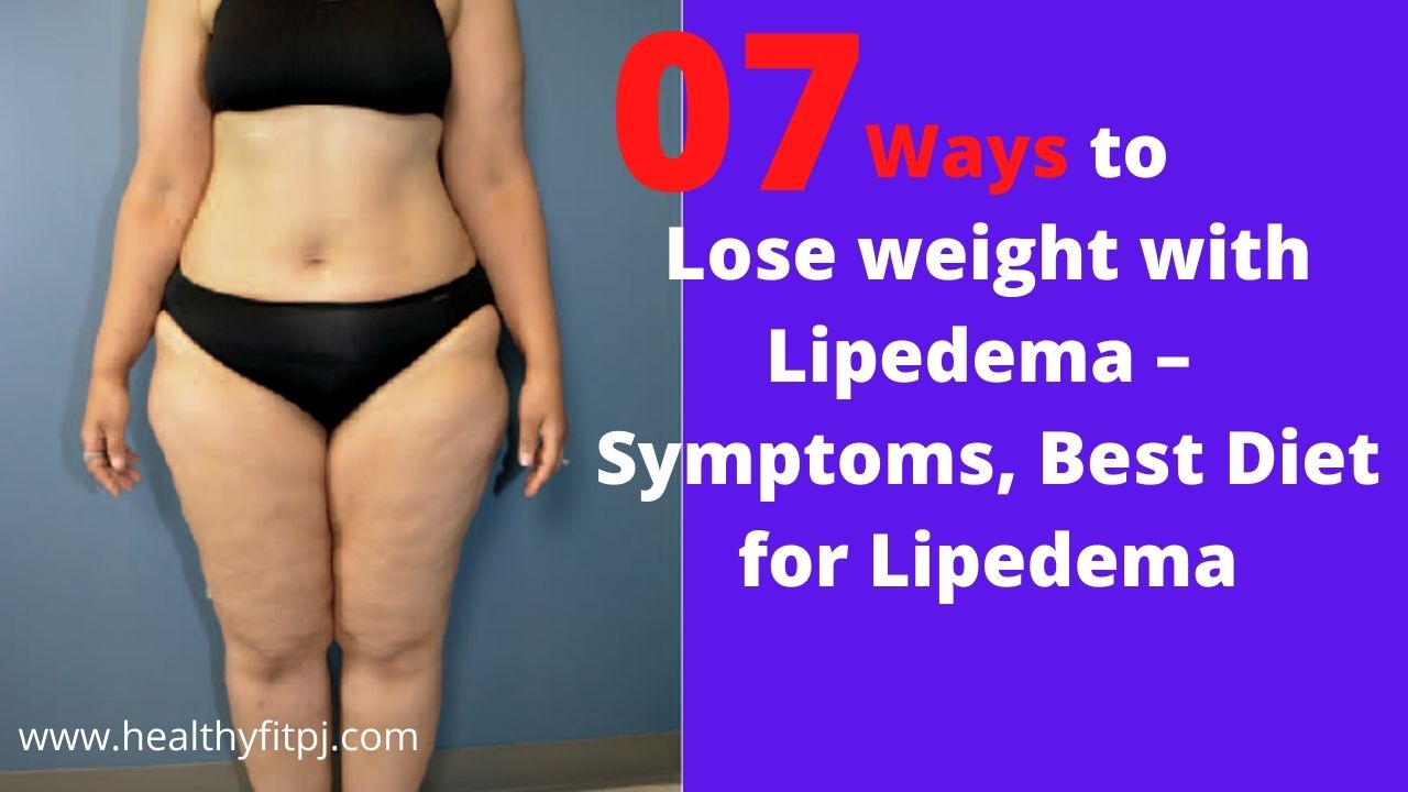 7 Ways to Lose weight with Lipedema – Symptoms, Best Diet for Lipedema
