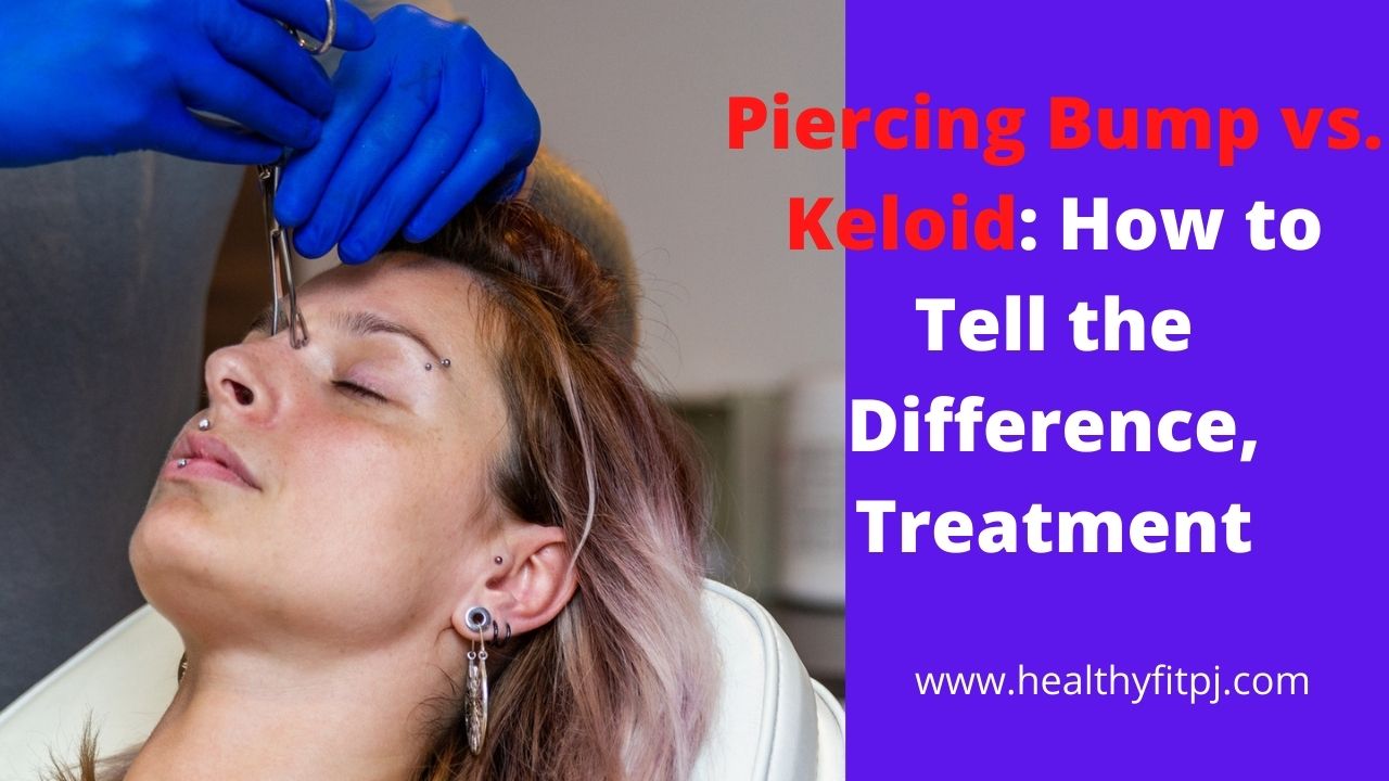 Piercing Bump vs Keloid: How to Tell the Difference, Treatment