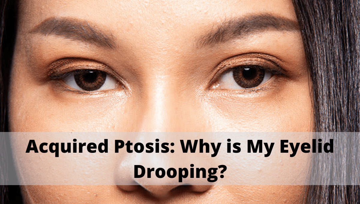 Acquired Ptosis: Why is My Eyelid Drooping?